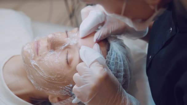Kosmetologen rengör ansiktet på akne med händerna. Professionell hudvård. Ansiktsrengöring — Stockvideo
