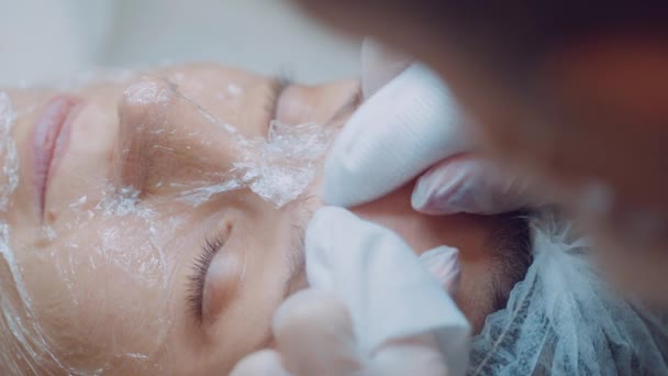 Mains rapprochées du cosmétologue nettoie le visage femme patiente de l'acné. soin de la peau. Nettoyage du visage — Video