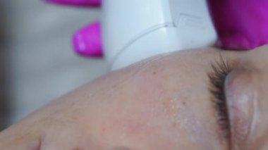 Kozmetoloji prosedürü sırasında kadın hasta yüzünün portresi güzellik dolabındaki aletin yardımıyla. Kaldırma, ameliyat, estetik ameliyat kavramı. Yüksek kalite 4k görüntü