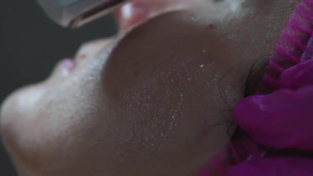 Porträtt Kvinnlig Patient Ansikte Kosmetologi Förfarande Med Hjälp Enhet Skönhetsskåp — Stockvideo