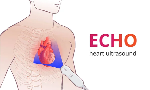 Echocardiography Technique Phase Array Ultrasound Transducer Placed Person Chest — Stock Vector