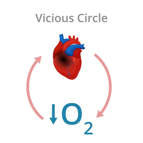 Vicious Circle Diagram Conceptual Illustration Heart Damage Due Low Oxygen — Stock Vector