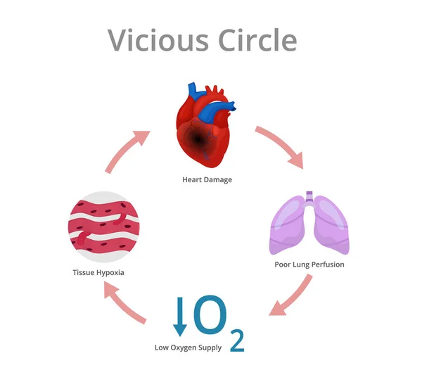 Vicious Circle Diagram Conceptual Illustration Heart Damage Pathophysiology — Stock Vector