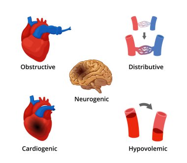 5 types of shock infographics. The diagram with the illustrations of five types of emergency conditions clipart