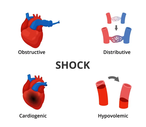 Types Shock Vector Diagram Medical Emergency Infographics — Vettoriale Stock