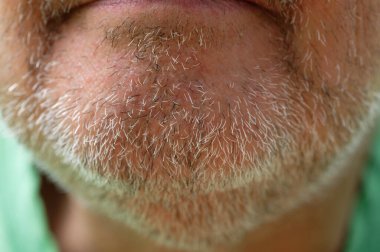 Orta yaşlı bir adamın çenesinde birkaç günlük sakal uzaması ya da sakal resmi var..