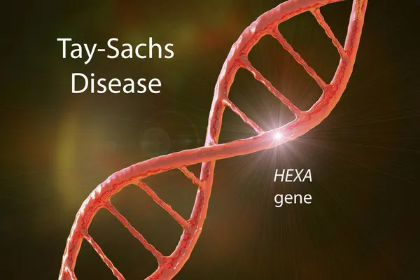 Tay Sachs Doença Ilustração Uma Desordem Genética Que Destrói Progressivamente — Fotografia de Stock