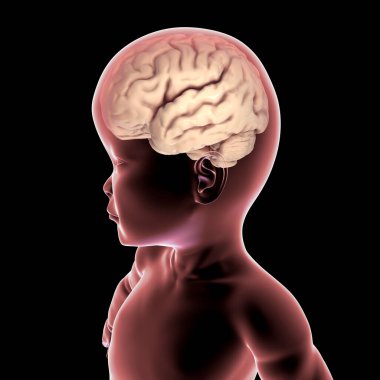 A child with macrocephaly and enlarged brain, 3D illustration. Pathologic macrocephaly with megalencephaly, genetic disorders clipart