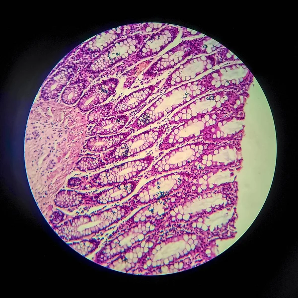 Bacillaire Dysenterie Licht Micrograaf Foto Onder Microscoop Waaruit Aanwezigheid Van — Stockfoto