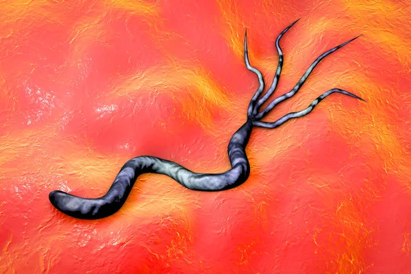 Ilustrace Helicobacter Pylori Bakterie Která Způsobuje Žaludeční Duodenální Vřed — Stock fotografie