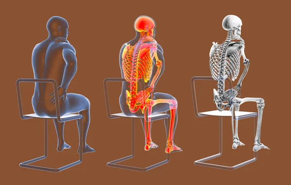 Human spine pain, backache, back pain, conceptual 3D illustration showing set of male bodies with and without highlighted skeleton and isolated skeleton having painful back. Dorsal view