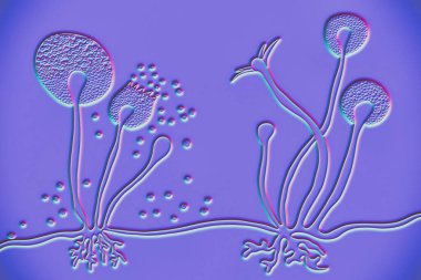 Rhizopus küf yapısı, ayrıca ekmek küfü olarak da bilinir, siyah mantar, 3 boyutlu illüstrasyon. Deri, burun sinüsleri, beyin ve akciğerleri kapsayan mukoza neden olan fırsatçı mantarlar. Covid-19 'un Karmaşıklığı