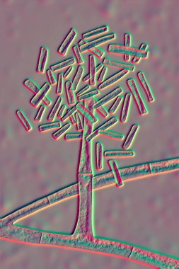 Mikroskobik mantar hormografisi, bilimsel 3 boyutlu illüstrasyon. Bağışıklık yetmezliği olan hastalarda ara sıra akciğer enfeksiyonlarına, kapakçık değişimi, göz ve deri enfeksiyonlarına neden olur.