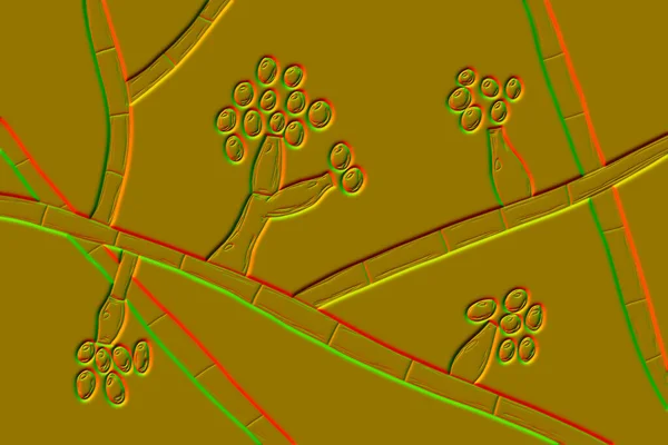 Μύκητες Μούχλας Madurella Τρισδιάστατη Απεικόνιση Μικροσκοπικός Μύκητας Που Προκαλεί Μυκητίαση — Φωτογραφία Αρχείου
