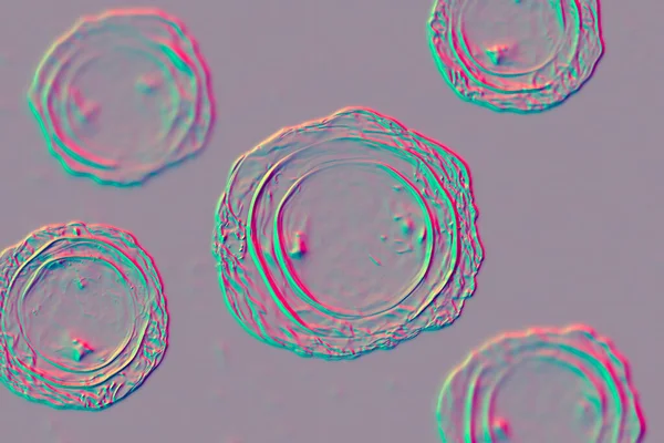 大きな丸虫 受精卵 3Dイラストであるアスカリスルムブリコイド — ストック写真