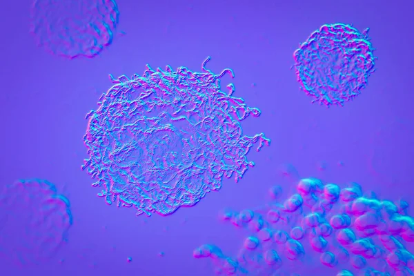 Καρκινοκύτταρα Κακοήθη Κύτταρα Επιστημονική Τρισδιάστατη Απεικόνιση — Φωτογραφία Αρχείου