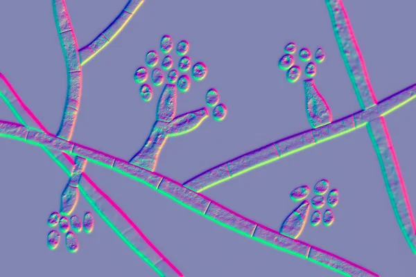 Плесень Иллюстрация Микроскопический Грибок Вызывающий Мицетому Черного Зерна Мадуромикоз Инфекцию — стоковое фото