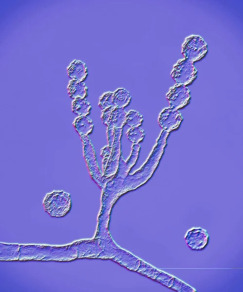 Mikroskopiska Svampar Scopulariopsis Brevicaulis Illustration Svamp Som Infekterar Naglar Orsakar — Stockfoto