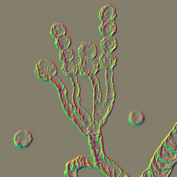 Mikroskopické Houby Scopulariopsis Brevicaulis Ilustrace Houba Která Infikuje Nehty Způsobuje — Stock fotografie
