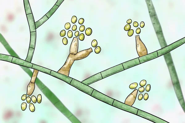 Champignons Moisissures Madurella Illustration Scientifique Champignon Microscopique Responsable Mycétome Grains — Photo