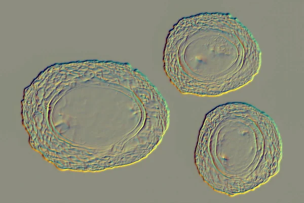 大きな丸虫 未受精卵 3Dイラストであるアスカリス リュンブリコイド — ストック写真