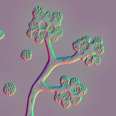 Mikroskobik mantar Cunninghamella, bilimsel 3 boyutlu illüstrasyon. Mucoraleler dizisindeki patojenik mantarlar sinopülmoner ve yaygın enfeksiyonlara neden olur. Mukomozisin nedensel etkenlerinden biridir.