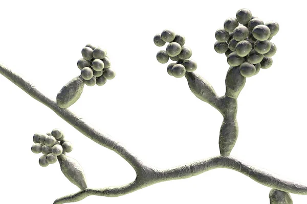 Houby Madurella Ilustrace Mikroskopická Houba Která Způsobuje Černozrnný Mycetom Nebo — Stock fotografie