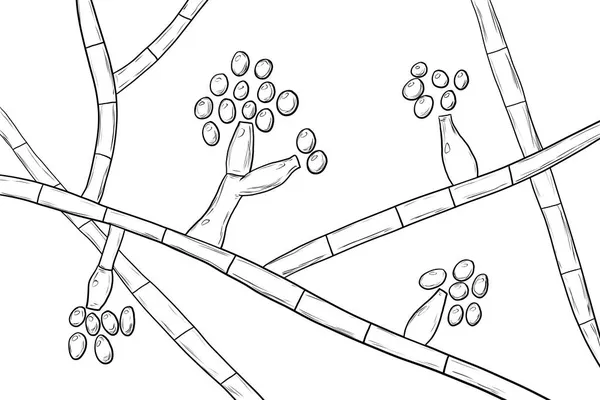 Schimmelpilze Madurella Wissenschaftliche Illustration Der Mikroskopisch Kleine Pilz Der Schwarzkornmycetom — Stockfoto