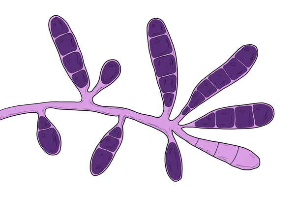 顕微鏡的真菌Epidermophyton凝集体 科学的なイラスト 線維性真菌で 運動選手の足 爪白癬などの皮膚や爪の感染症を引き起こします — ストック写真