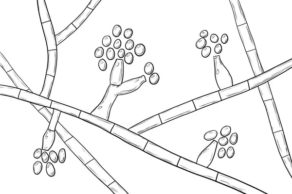 Schimmelpilze Madurella Wissenschaftliche Illustration Der Mikroskopisch Kleine Pilz Der Schwarzkornmycetom — Stockfoto