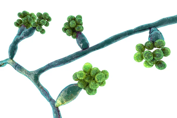 Muffa Funghi Madurella Illustrazione Fungo Microscopico Che Causa Micetoma Grani — Foto Stock
