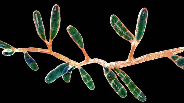 Mikroskopiska Svampar Epidermophyton Floccosum Vetenskaplig Illustration Filamentös Svamp Orsakar Hud — Stockfoto