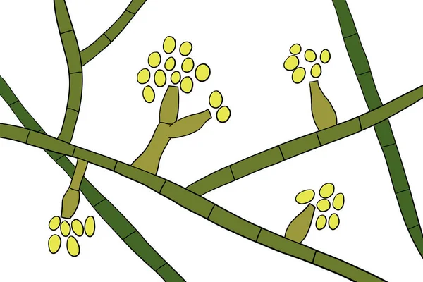 Hongos Del Molde Madurella Ilustración Científica Hongo Microscópico Que Causa —  Fotos de Stock