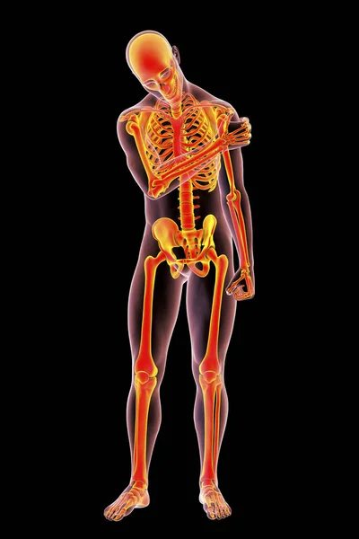 Shoulder Pain Conceptual Illustration Showing Human Male Body Highlighted Skeleton — Fotografia de Stock