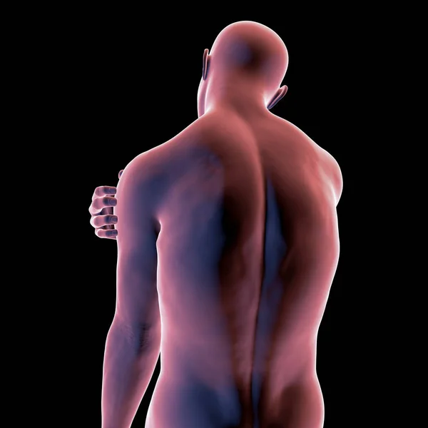 Shoulder Pain Conceptual Illustration — Stock Photo, Image