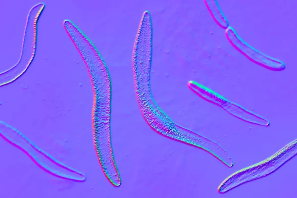 Fusobacterium Illusztráció Szájüregi Baktérium Fogágybetegségek Fogágybetegség Kialakulása Torokfájás Lemmieres Szindróma — Stock Fotó