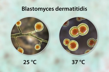 Blastomyces dermatidis fungi, akciğerlerde ve diğer organlarda blastomikozun nedensel faktörü, 3 boyutlu illüstrasyon. Dimorfik mantarlar lifli (25 derecede) ve maya (37 derecede) formları üretirler.