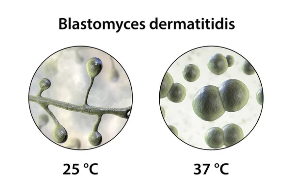 Blastomyces Dermatitidis Fungi Veroorzaker Van Blastomycose Longen Andere Organen Illustratie — Stockfoto