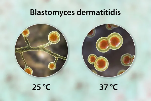 Blastomyces Dermatitidis Fungi Veroorzaker Van Blastomycose Longen Andere Organen Illustratie — Stockfoto