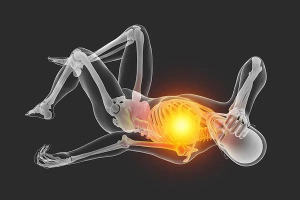 Menselijk Mannelijk Lichaam Met Skelet Een Slecht Gevoel Bewusteloosheid Positie — Stockfoto