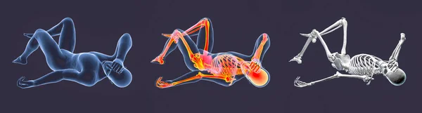 Nsan Vücudu Kötü Hissetme Pozisyonunda Boyutlu Çizim Şaretlenmiş Iskeleti Izole — Stok fotoğraf