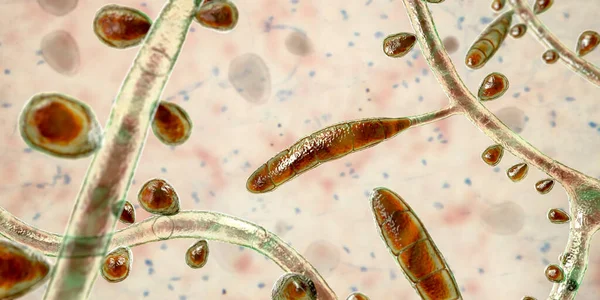 Fungus Trichophyton Rubrum Illustration Showing Macroconidia Microconidia Septate Hyphae Infects — Stock Photo, Image