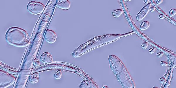 Pilz Trichophyton Rubrum Illustration Mit Makrokonidium Mikrokonidien Und Septate Hyphen — Stockfoto