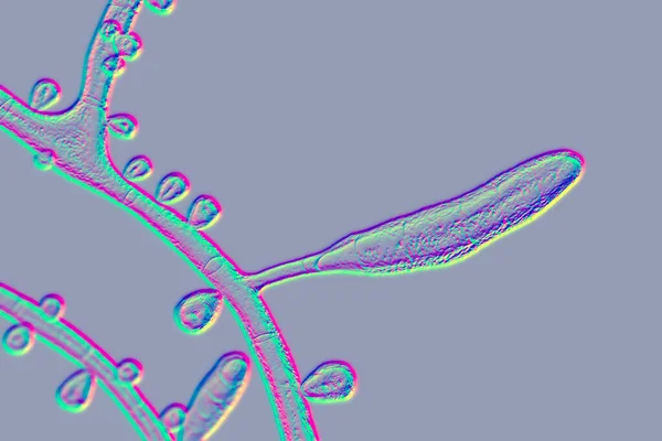 Hongo Trichophyton Rubrum Ilustración Que Muestra Macroconidium Microconidios Hifas Septas — Foto de Stock