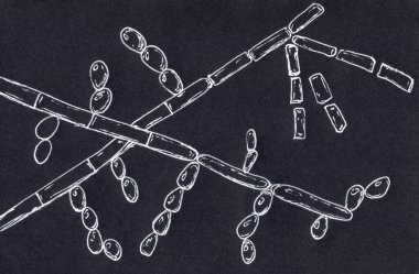 Mikroskobik mantar Trichosporon, el yapımı illüstrasyon septik hyphae, psödohyphae, blastoconidia tek başına veya kısa zincirlerde, artroconidia gösteriyor. Beyaz piedra, yüzeysel, istilacı enfeksiyonlara neden olur.