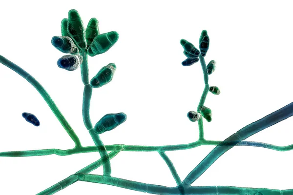 Μικροσκοπικά Μύκητες Μούχλα Curvularia Επιστημονική Εικόνα Curvularia Προκαλεί Κερατίτιδα Χρόνια — Φωτογραφία Αρχείου