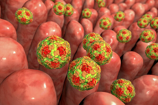 Hepatitis A viruses infecting intestine, 3D illustration