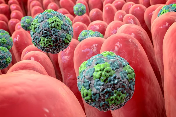 Hepatitis A viruses infecting intestine, 3D illustration
