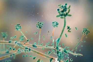 Küf mantarı Acremonium (eski adıyla Cephalosporium), 3 boyutlu illüstrasyon. Beyaz tanecikli miketom, tırnak enfeksiyonları, keratit.