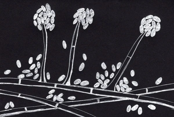Schimmelpilze Acremonium Ehemals Cephalosporium Wissenschaftliche Illustration Äthologische Erreger Von Weißkornmycetomen — Stockfoto
